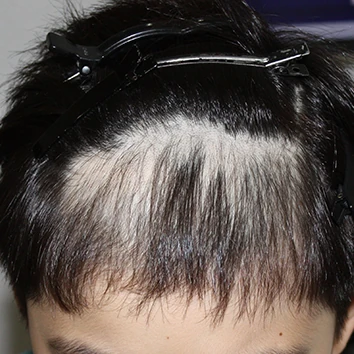 발머스한의원 노원점 치료 전
