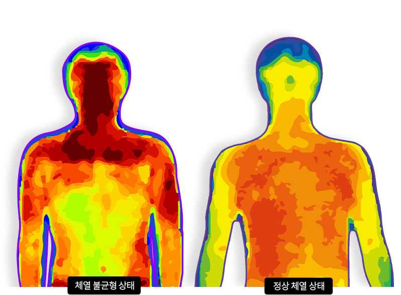 체열 불균형 상태 vs 정상 체열 상태