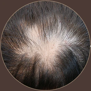발머스한의원 부산연산점 치료 전